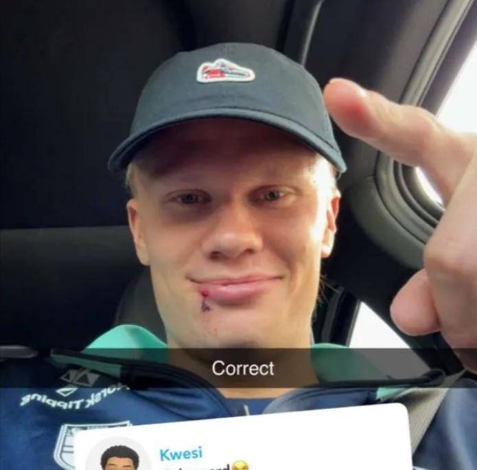 关于哈兰德在DWG比赛中比赛规则变更，表现优异引发热议！观众掌声雷动的信息